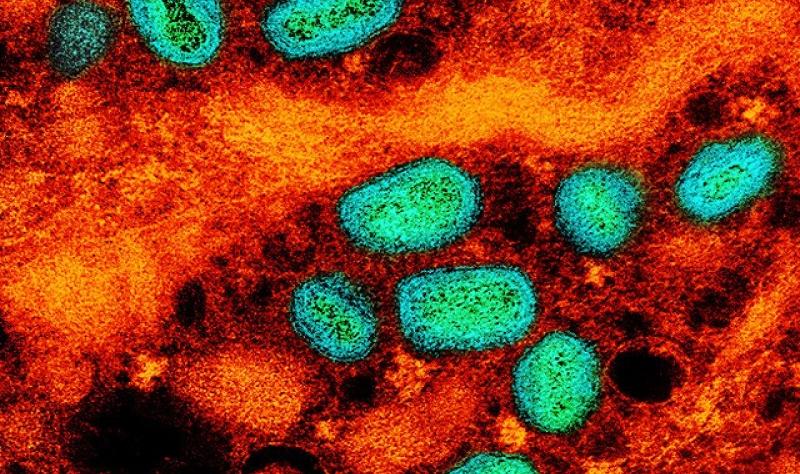 Global mpox cases decline, but cases up slightly in 2 regions | CIDRAP
